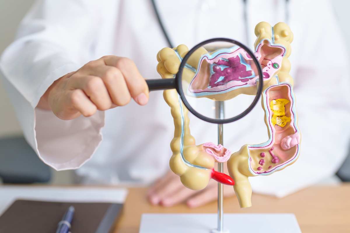 Un modello di colon esaminato da uno specialista