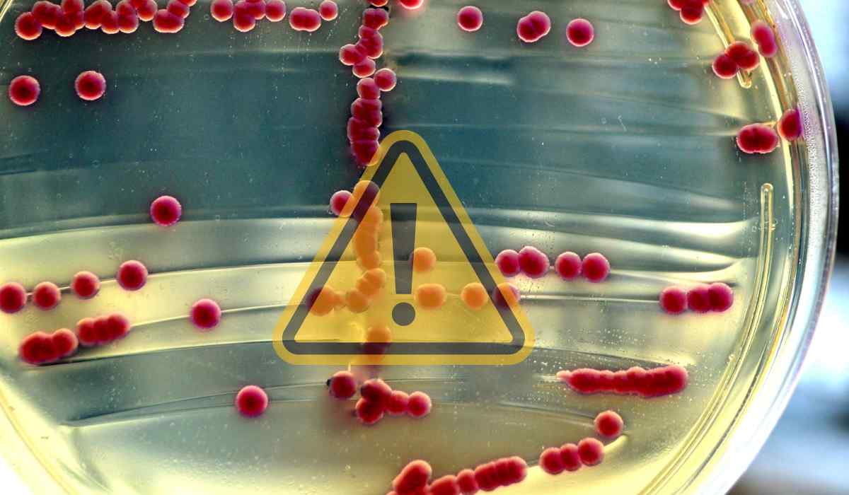 Il batterio della Escherichia coli al microscopio