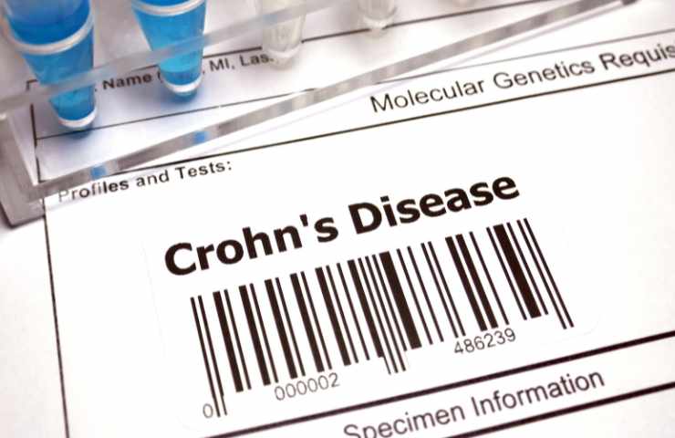 Una diagnosi di morbo di Crohn