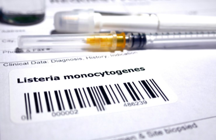 Una diagnosi da Listeria monocytogenes