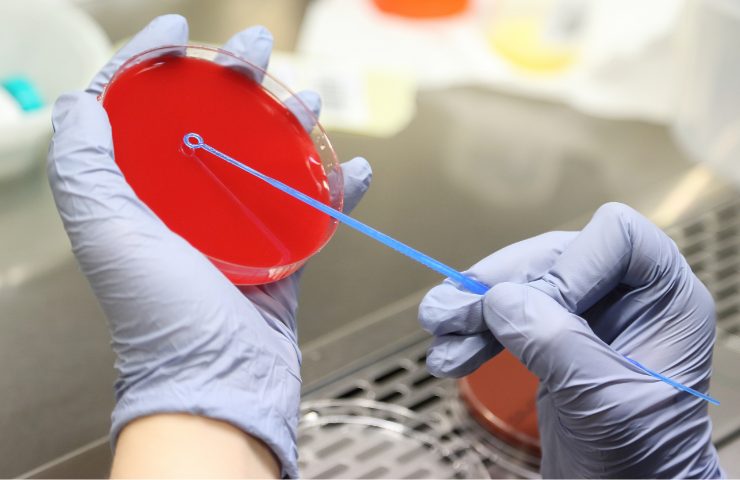 Analisi di laboratorio in corso